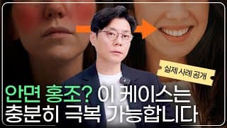 실핏줄이 보이는 홍조를 치료하는 방법(+실제 치료 사례)