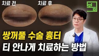 딱 봐도 티나는 쌍수 흉터,
깔끔하게 없애는 방법?