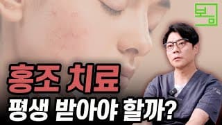 홍조 치료, 얼마나 받아야 좋아질까? (치료기간, 주의사항)