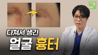 얼굴에 생긴 흉터, 치료할 수 있을까?