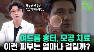 여드름 흉터,
모공이 심한 분들은 좋아지는데
0개월 정도 걸립니다